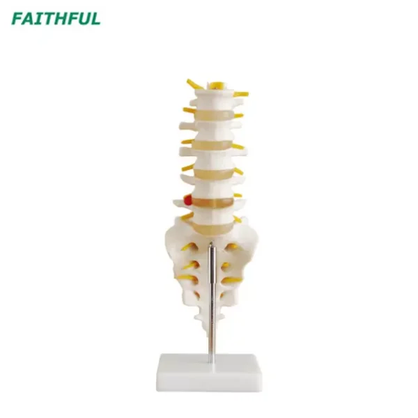 Lumbar Vertebrae with Sacrum & Coccyx and Herniated Disc XC-119 Series