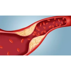 Lipid Profile